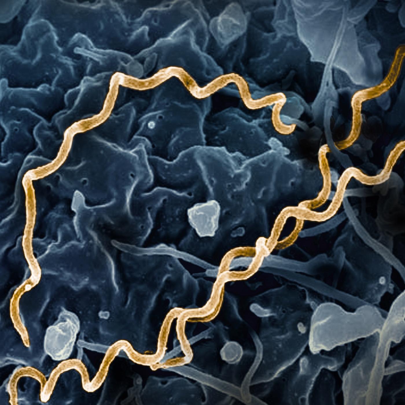 Syphilis: The Great Masquerader Syphilis: The Great Masquerader